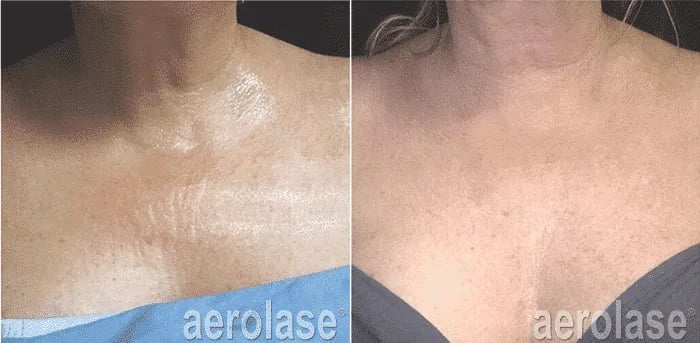 Emer-Rejuvenation