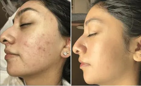  Before & After
